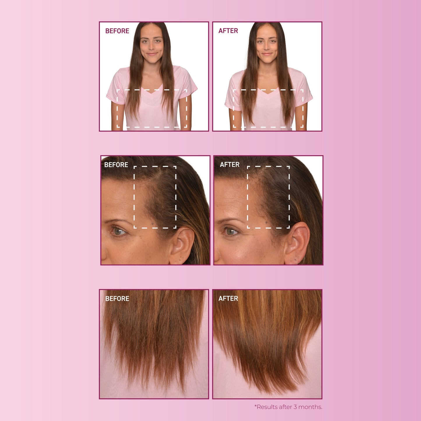 Before and after images of female hair growth.