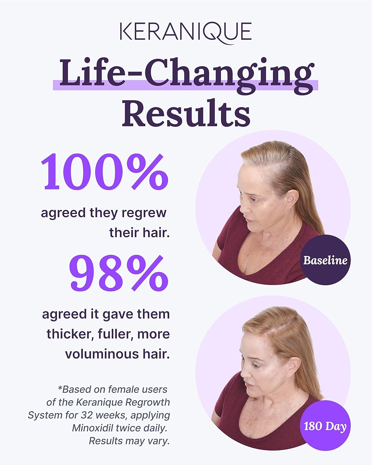 Minoxidil Hair Growth Treatment - One Time Purchase
