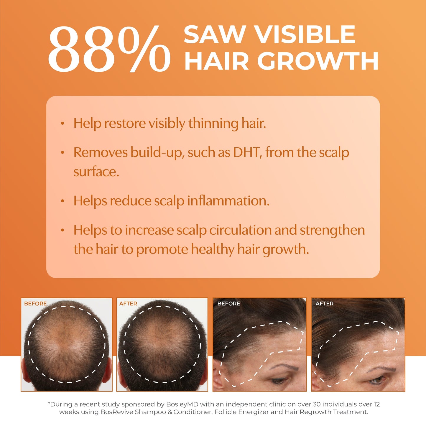 88% saw visible hair growth with male and female before and after images.