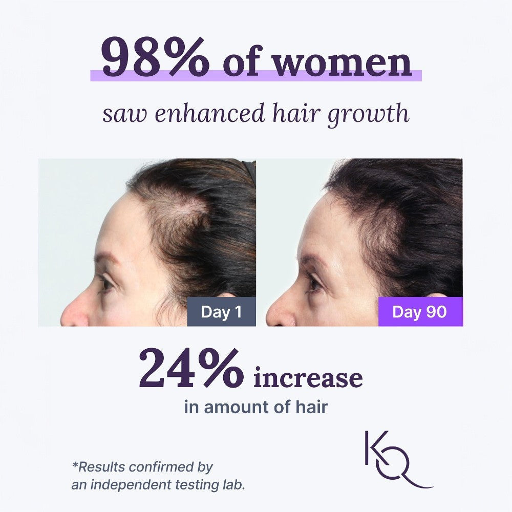 Keranique Hair & Scalp Supplements - One Time Purchase